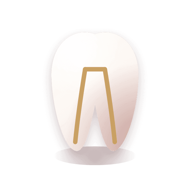 Root canal treatment